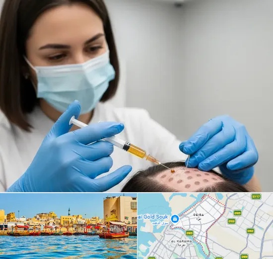 PRP Hair Treatment in Deira