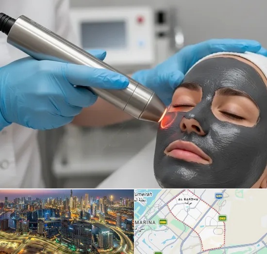 Carbon Laser Peel in Al Barsha