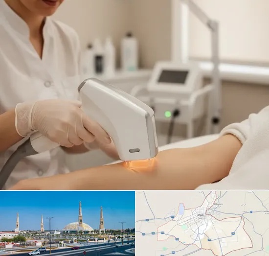 IPL Hair Removal in Al Ain