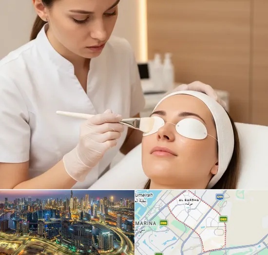 Chemical Peels in Al Barsha