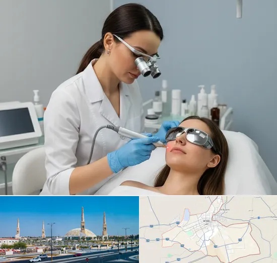 Acne Treatments in Al Ain