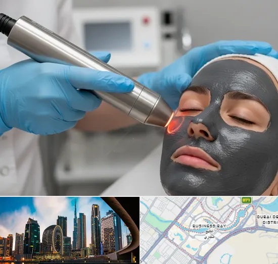Carbon Laser Peel in Business Bay