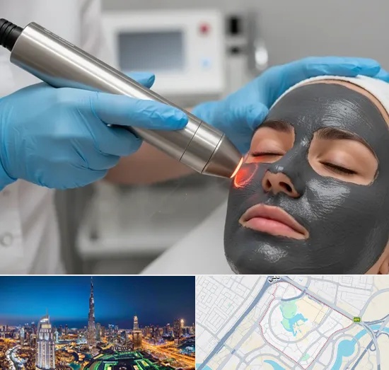 Carbon Laser Peel in Downtown Dubai