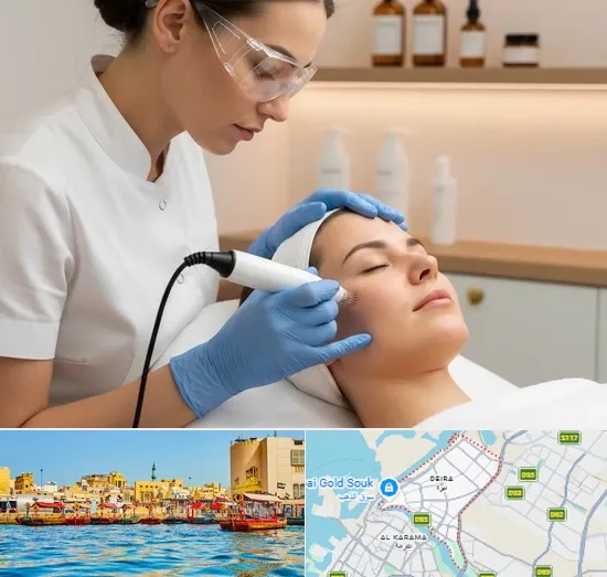 Microneedling in Deira