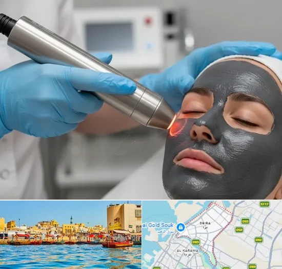 Carbon Laser Peel in Deira